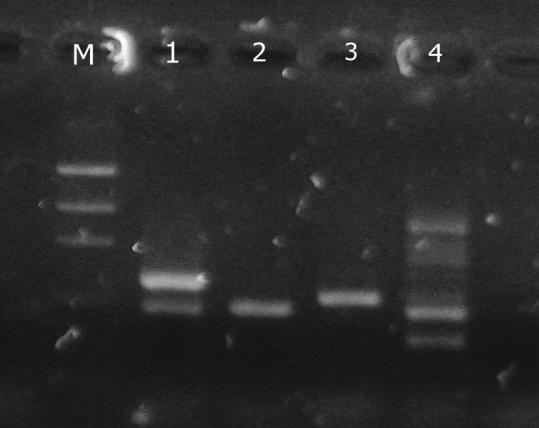 Gambar 1. Eletroforesis Produk PCR dengan Gel Agalrose 1% yang diwarnai Etidium Bromide dengan Marker 100 bp DNA Ladder.