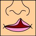 Sumber : http://en.wikipedia.org/wiki/cleft_lip_and_palate Celah bibir dan langitan, celah melewati kedua sisi premaksila, foramen insisivum, palatum keras dan palatum lunak. Gambar 2.