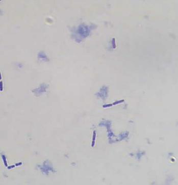 (a) (b) (c) Gambar 5. Hasil Pewarnaan Gram dan Morfologi Bakteri Lactobacillus. plantarum : L. plantarum 1A5 (a); L. plantarum 1B1 (b); L. plantarum 2B2 (c); dan L.