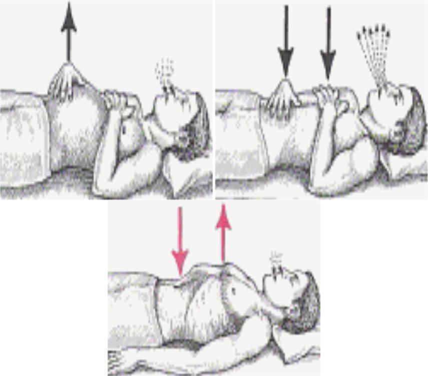 36 berperan penting dan memungkinkan mempengaruhi peningkatan kerja otot-otot abdomen yang berperan pada proses ekspirasi (Chark, 1993). 2.4.2 Pelatihan Diaphragmatic Breathing Exercise Gambar 2.