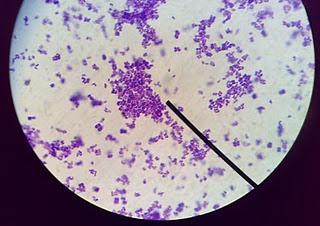 10 Gambar 3 Staphylococcus aureus (Schnnewld et al., 1995) G. Levamisol Levamisol memiliki efek imunostimulan pada hewan coba dan manusia karena kemampuanya meningkatkan imunitas seluler.