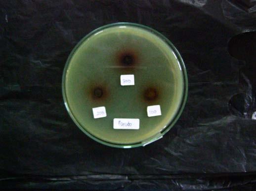 ) terhadap Bakteri terhadap Bakteri Pseudomonas aeruginosa Keterangan: A.