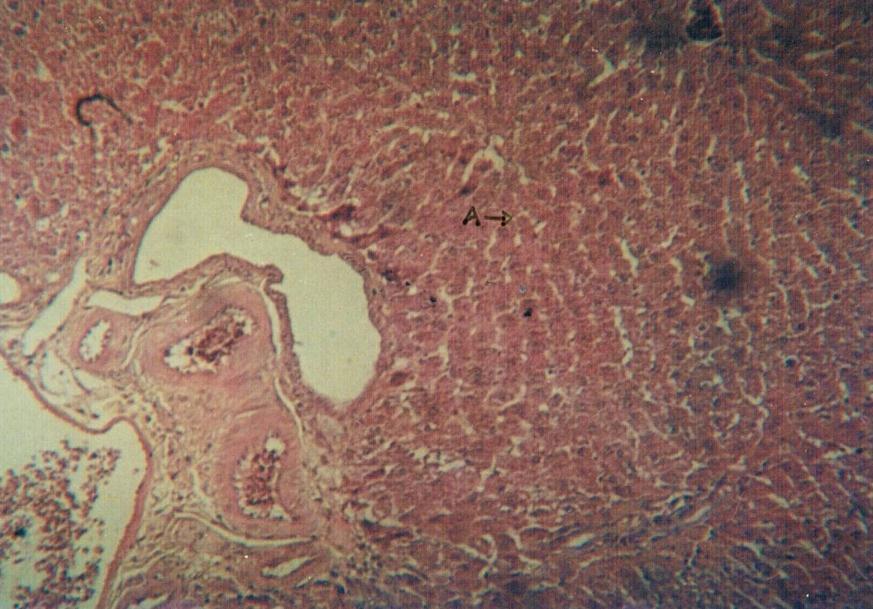 dan eosinofilik sitoplasma serta celah sinusoid terlihat dengan jelas, vena sentralis masih utuh, meskipun ransum lemak tinggi terus diberikan selama 3 bulan tetapi tidak menyebabkan terjadi