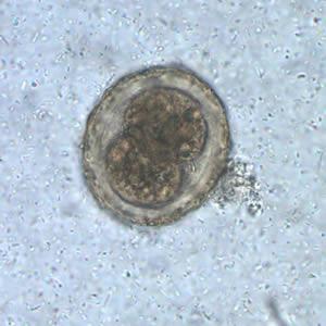 Telur ascaris ditemukan dalam dua bentuk, yaitu yang dibuahi (fertilized) dan tidak dibuahi (unfertilized). a. Telur dibuahi (fertilized) Bentuk telur bulat dan lonjong dengan ukuran panjang 45 75 mikron dan lebarnya 35-50 mikron.