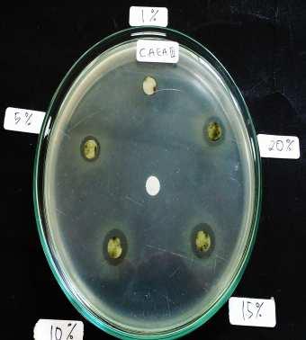Escherichia coli, (j) Staphylococcus