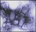 ABIES: Etiologi Asep SIFAT FISIK Virus mati pada suhu 60 C, 5 menit