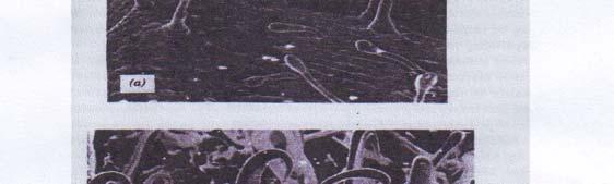 Gambar 2 : Morfologi bulu-bulu daun tanaman yang tahan dan yang peka terhadap hama penggerek gambar (a)