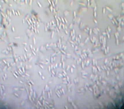 15 TINJAUAN PUSTAKA Biologi Penyakit Colletotrichum gleosporioides Penz. Sacc 