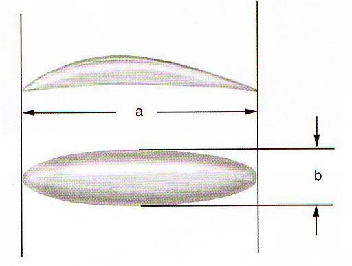 Jenis dorsocolumellar dirancang untuk membantu proyeksi ujung dan juga bertindak sebagai pen-stabil yang kokoh untuk bagian dorsal dengan menjaganya agar tetap dalam orientasi garis tengah.