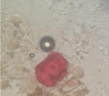 Pemeriksaan mikroskopik fragmen penanda pada Zingiberis officinalis rhizoma, (a) berkas pembuluh, (b) jaringan