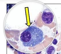 Sel plasma SIZE : 14-18 µm SHAPE : oval STAINNING : sitoplasma biru,