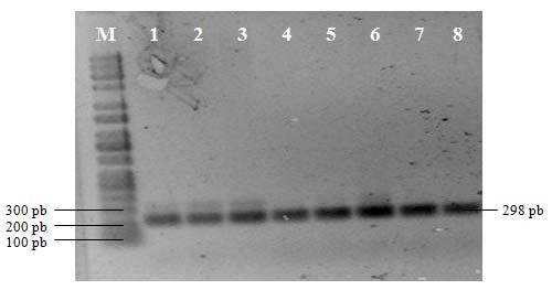 PUTRA et al. Polimorfisme gen GHR pada sapi Pasundan 301 direndam larutan 1 x TBE pada tegangan 110 volt selama 50 menit, kemudian divisualisasikan dalam G-BOX.