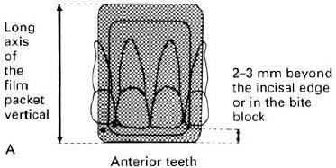 (insisivus dan kaninus) panjang film diletakkan vertikal, sedangkan untuk gigi belakang (premolar dan molar) secara