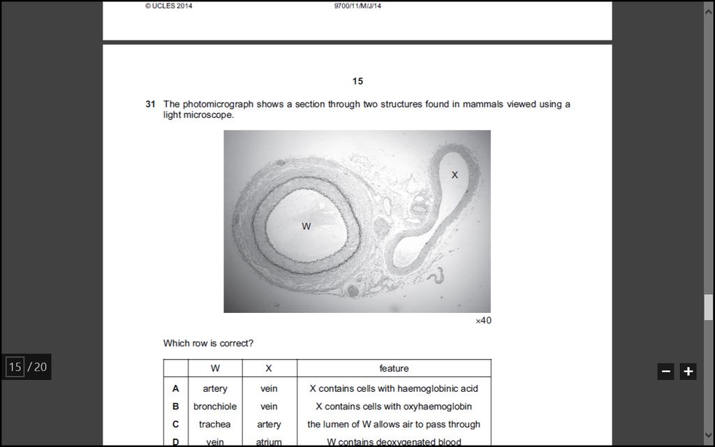 Bayi dengan kromosom sex XX dan mengalami gangguan ini perkembangan organ kelamin eksternal 19.