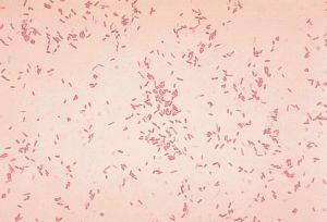 16 Gambar 13 Aeromonas sp., pewarnaan Gram, perbesaran objektif 100x Genus Pseudomonas sp. merupakan bakteri Gram neif.