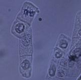 Gambar 5 Metafase ` ` Kromosom Gelendong Profase Berdasarkan pengamatan proses mitosis pada preparat squash akar bawang merah Gambar 5 salah satu fase yang berhasil terlihat adalah fase metafase.