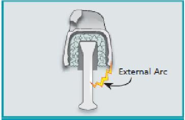 Isolator piring gelas ketika telah pecah akan meninggalkan bongkol isolator yang disebut dengan istilah stub.