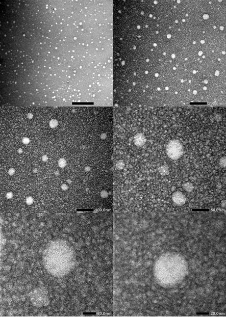 g3 Gambar 3. Morfologi globul nanoemulsi astaxanthin (perbesaran 20 nm hingga 500 nm). dispersi yang terbentuk bersifat lebih stabil untuk jangka panjang [14].