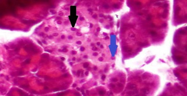 Gambar 5. Histopatologis pankreas hewan coba pada dosis 100 mg/kg BB dengan perbesaran 100x. Gambar 6. Histopatologis pankreas hewan coba pada dosis 200 mg/kg BB dengan perbesaran 100x.