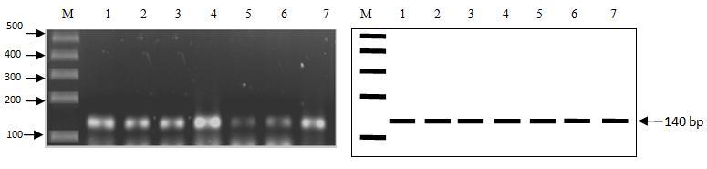 25 HASIL DAN PEMBAHASAN Amplifikasi Gen BMPR-1B dan BMP-15 Amplifikasi fragmen gen BMPR-1B dan BMP-15 pada DEG-Lombok menghasilkan DNA target dengan masing-masing panjang produk 140 bp (base