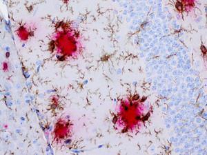 3. Mikroglia Badan sel mikroglia kecil, padat, dan gepeng Memiliki prosesus yang pendek dan ditutupi oleh banyak juluran