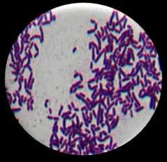 22 3.4.1. Hasil Uji Pewarnaan Gram Isolat bakteri yang berupa koloni tunggal dan memiliki zona bening selanjutnya diambil untuk dilakukan uji pewarnaan Gram.