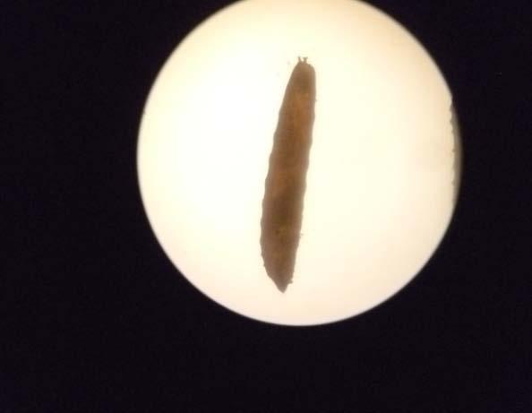 phaseoli dibawah mikroskop 