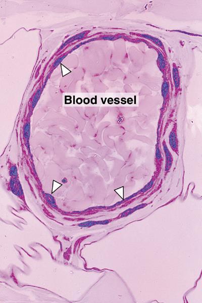 All blood vessels are lined with a simple squamous epithelium called