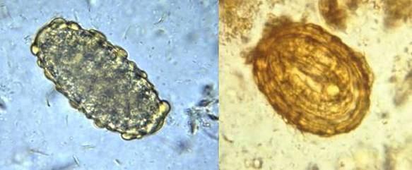 5 Gambar 2.3 Telur cacing Ascaris lumbricoides. (a) telur yang tidak dibuahi, (b) telur yang dibuahi (PHIL 411/4821 - CDC/Dr. Mae Melvin) b.