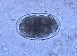 7 Gambar 2.6 Telur Hookworm (PHIL 5220 CDC) b.