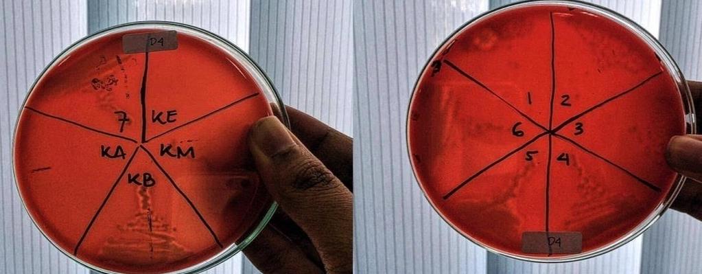 38 dengan pelarut DMSO dan aquades dapat menghambat perkembangbiakan bakteri Staphylococcus aureus, dengan nilai KHM ekstrak etanol sirih merah dengan pelarut DMSO 10% lebih rendah yakni pada