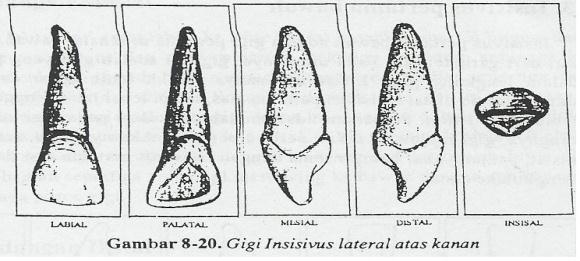 Insisivus sentral atas kanan 1. Permukaan mesial lurus dan terletak pada sudut tegak lurus tajam ke tepi insisal. Sudut disto-insisal lebih bulat 2.