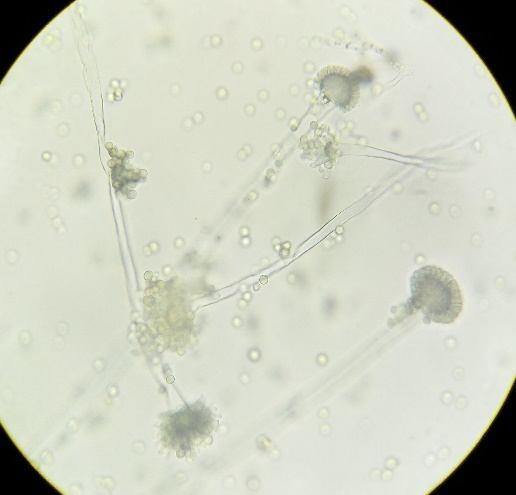 Gambar 2 Hasil Pengamatan Jamur Aspergilus sp setelah pembiakan pada media SDA Ket : 1. Konidium 2. Vesikel 3.