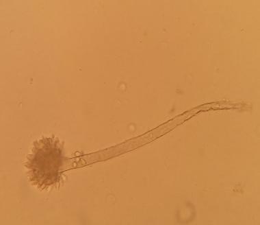 Gambar 3 Hasil Pengamatan Jamur Aspergillu Setelah Pembiakan Pada Media SDA Hifa bersekat, bentuk seperti kipas konidiospora, sterigma. Hasil tersebut diidentifikasi sebagai jamur Aspergillus sp.