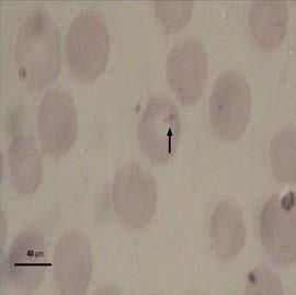 Gambar 12 Gambaran mikroskopis Theileria sp. berdasarkan hasil pengamatan Babesia sp. Morfologi Babesia sp. yang ditemukan berbentuk seperti buah pear, sepasang maupun tunggal. Babesia sp. sesuai dengan gambaran Babesia sp.