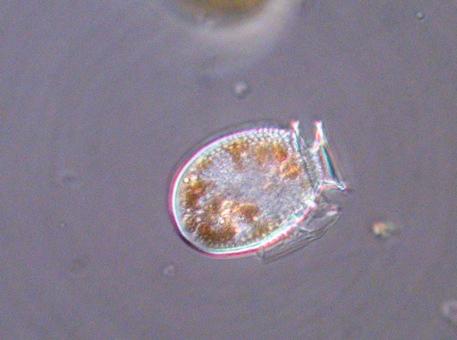 Fitoplankton Chaetoceros