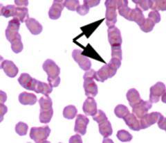18 (Silverthorn 2006). Sel darah merah luak memiliki kemiripan stuktur dengan sel darah merah kuda dan kucing, yaitu membentuk susunan tumpukan uang logam atau disebut juga rouleaux.