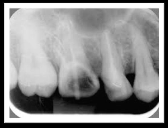 Sementum Gambar 3. Sementum 11 4. Tulang alveolar Prosesus alveolaris adalah bagian tulang rahang yang menopang gigi geligi.