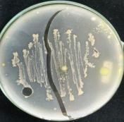 menumbuhkan spora isolat Rare Actinomycetes