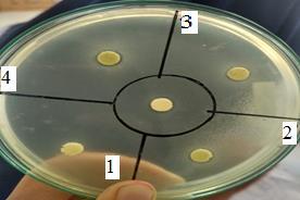Staphylococcus aureus Penanaman bakteri