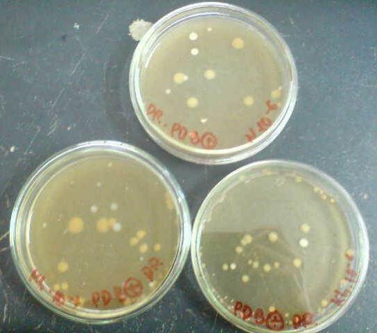 Lampiran. Penampakan Koloni E. coli, S.