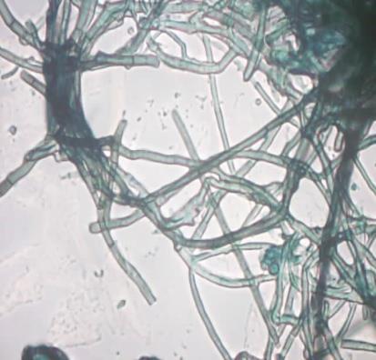 Hasil pengamatan mikroskopik isolat jamur endofit hijau kehitaman 1 memiliki konidiofor dan hifa.