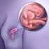BAB 2 TINJAUAN PUSTAKA. kehamilan yang akut dan dapat terjadi ante, intra, dan postpartum. Dari gejala-gejala