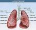 Kadang kanker paru (terutama adenokarsinoma dan karsinoma sel alveolar) terjadi pada orang