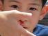 Artikel Asli. Kata kunci: karsinoma nasofaring anak, KNF, onkologi