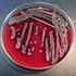 SHIGELLA. Klasifikasi. : Proteobacteria : Gamma Proteobacteria : Enterobacteriaceae. : Shigella dysentriae