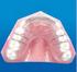 BAB I PENDAHULUAN. permukaan oklusal gigi geligi rahang bawah pada saat rahang atas dan rahang