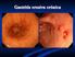 BAB 2 TINJAUAN TEORITIS. inflamasi/peradangan. Gastritis adalah peradangan pada mukosa lambung.