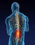 BAB II TINJAUAN PUSTAKA. Low back pain (LBP) dapat disebabkan oleh penyakit atau kelainan yang berasal