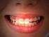 BAB I PENDAHULUAN. Susunan gigi yang rapi serta warna gigi yang putih merupakan faktor yang
